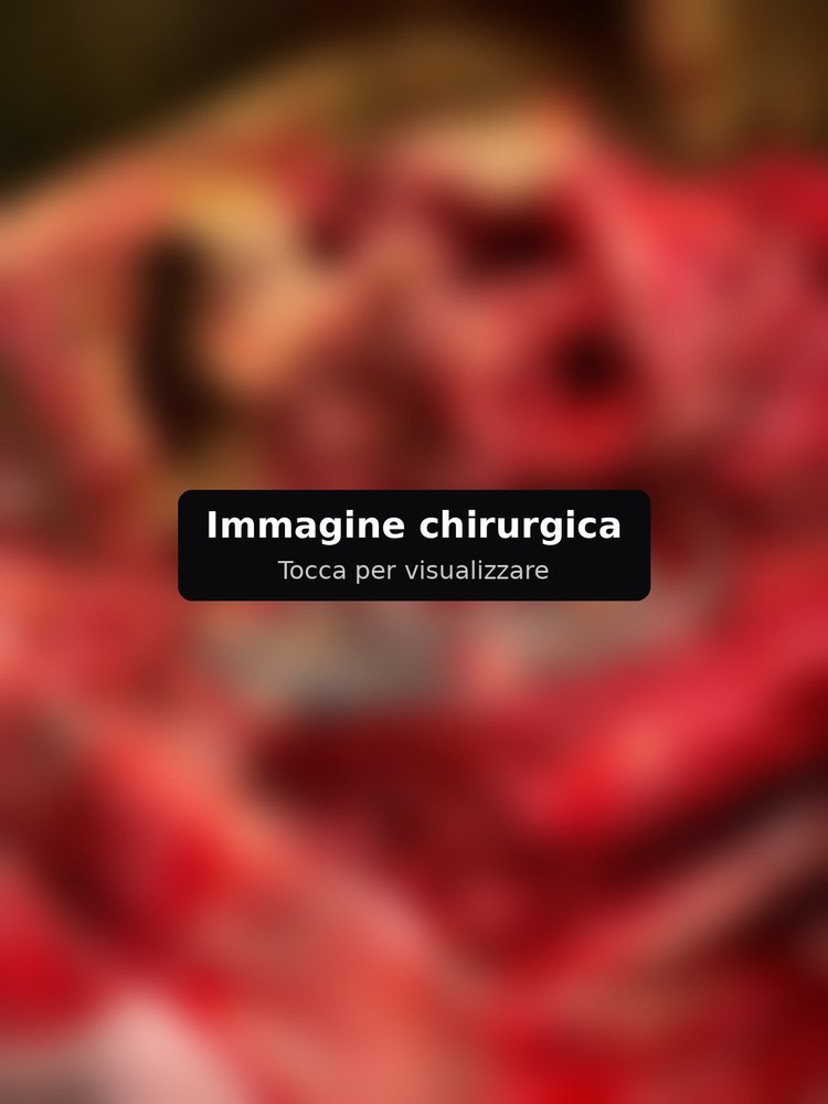 Immagine chirurgica sfocata
