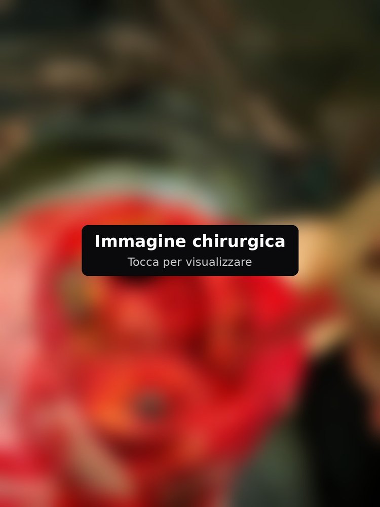 Immagine chirurgica sfocata