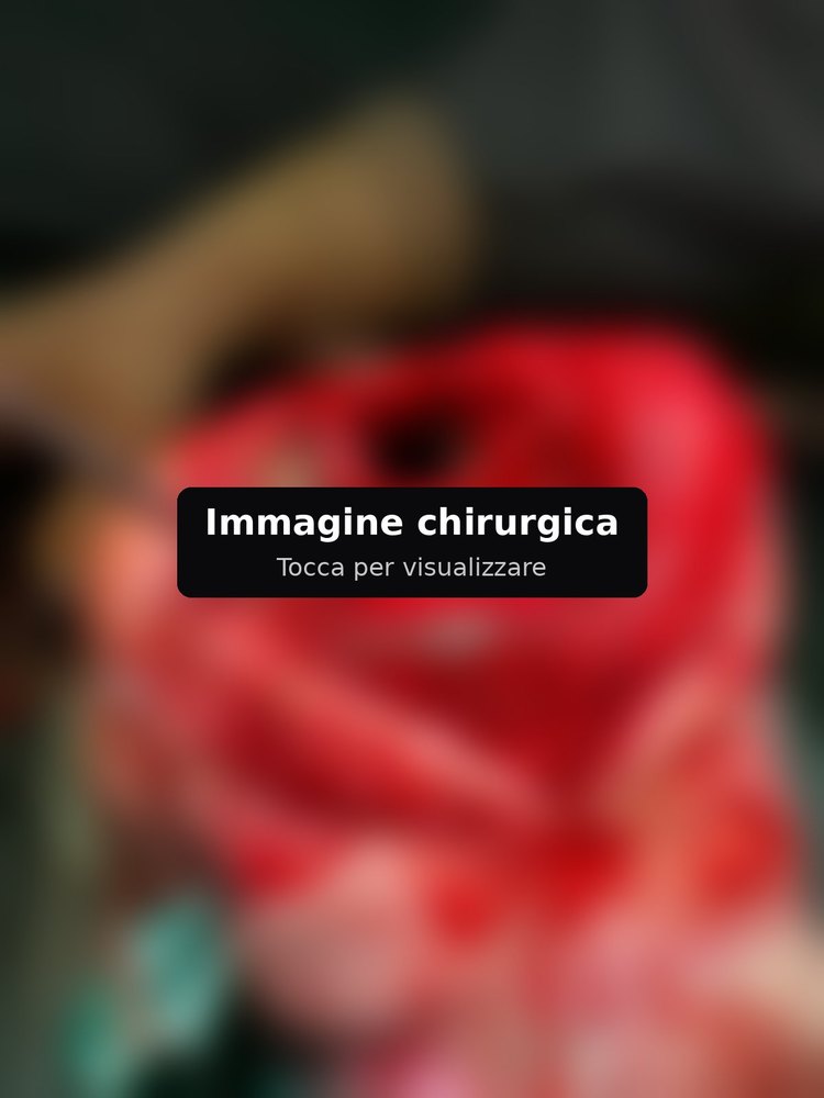 Immagine chirurgica sfocata
