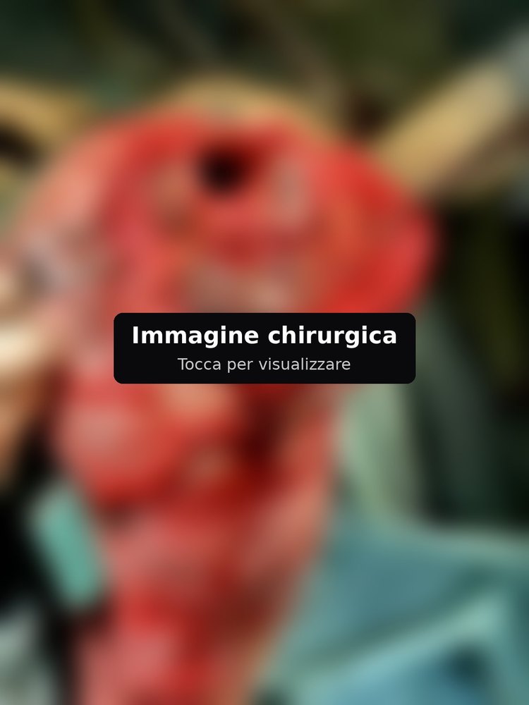 Immagine chirurgica sfocata