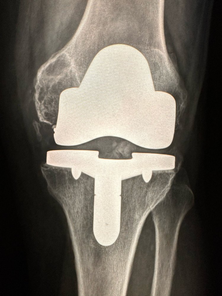 Radiografia 2025