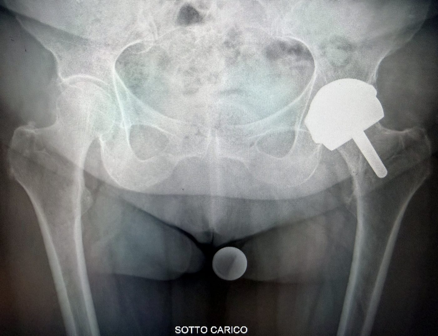 Radiografia prima dell’intervento