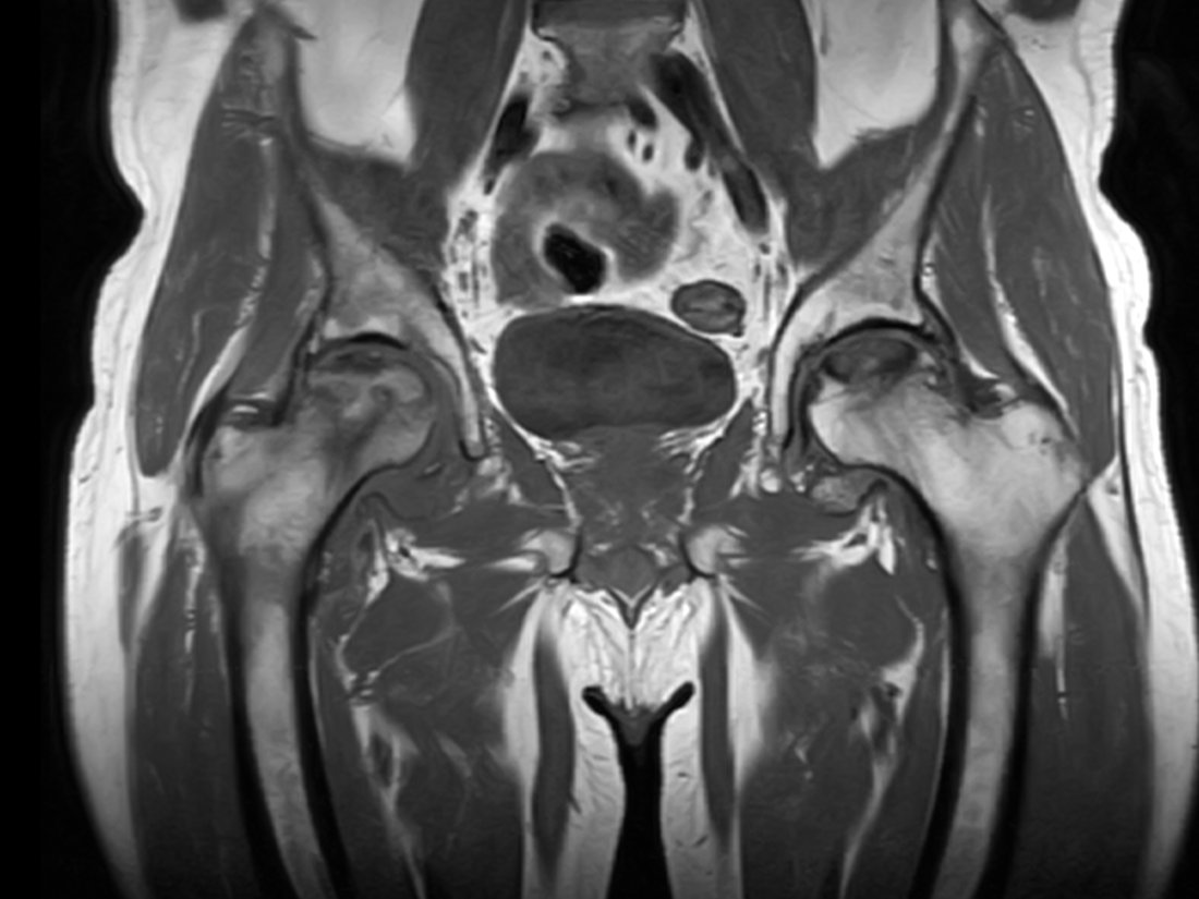 Risonanza magnetica: diagnosi precoce
