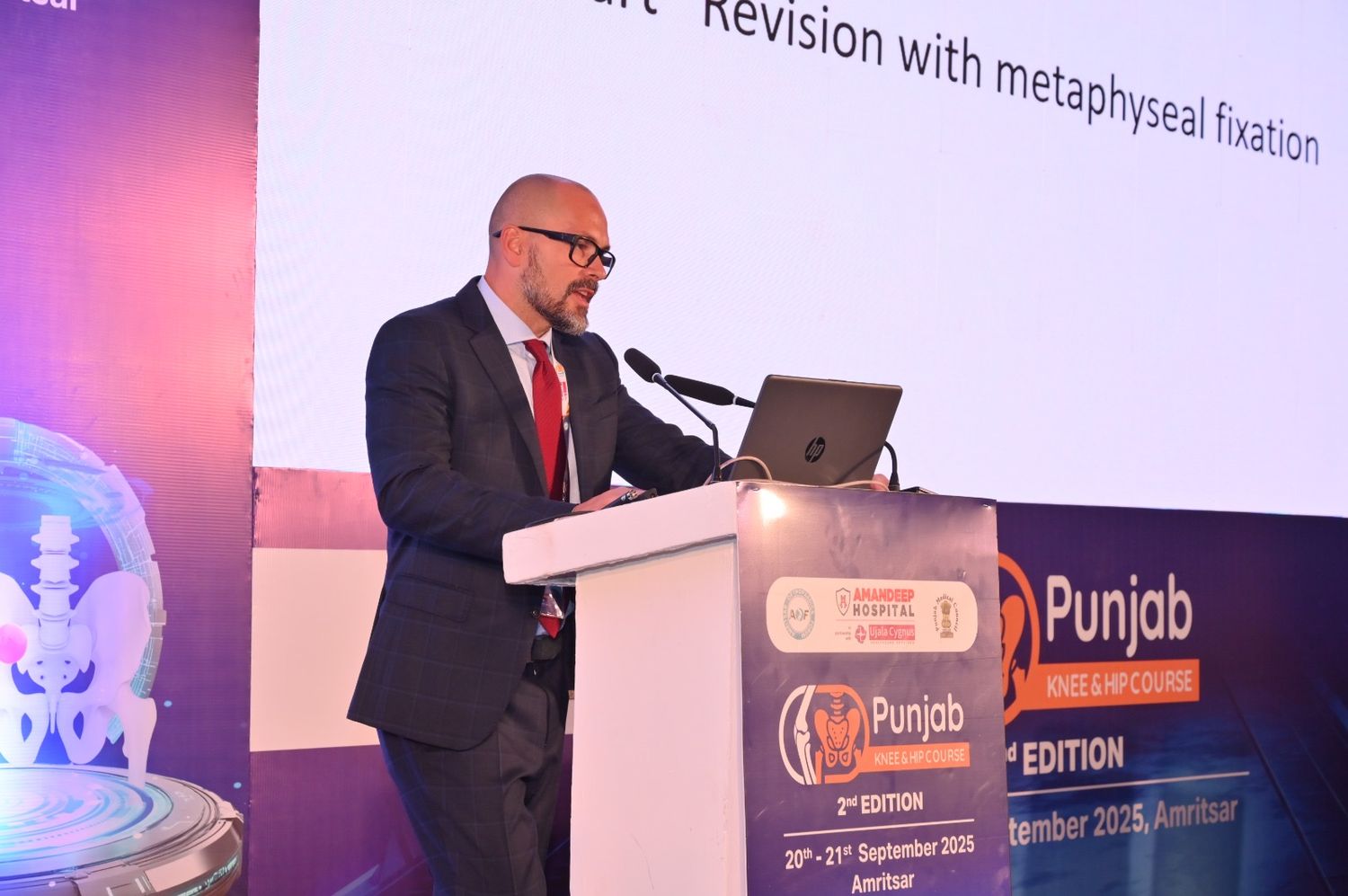 Dr Pierattilio Lupi lecturing on revision knee arthroplasty with metaphyseal fixation at the Punjab Knee and Hip Course in Amritsar, India