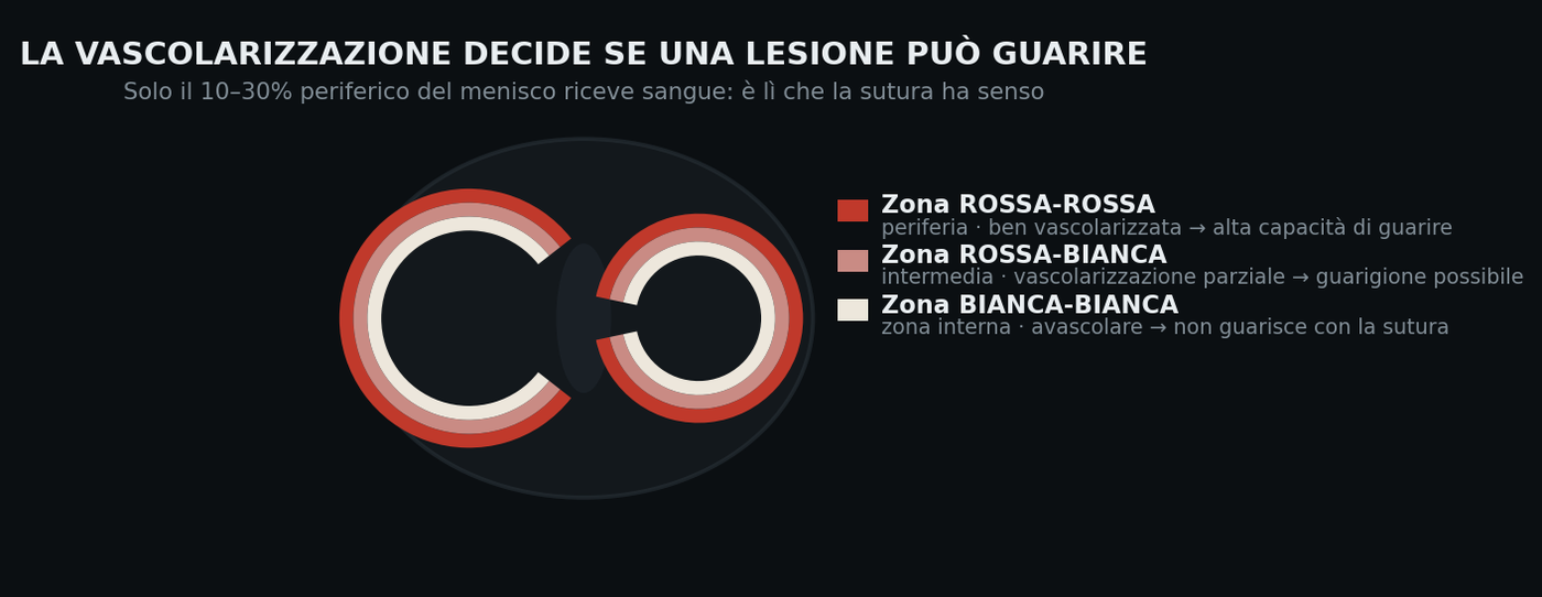 Le tre zone vascolari del menisco. Solo la periferia ha un apporto di sangue sufficiente alla guarigione.