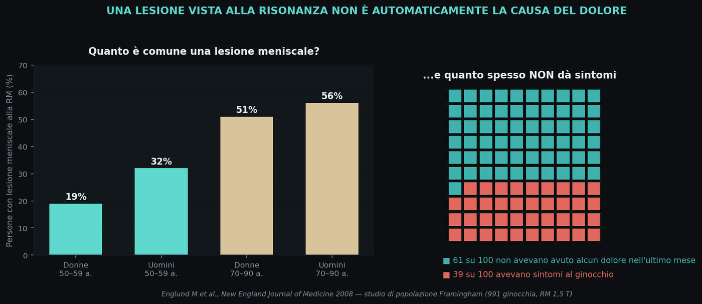 Dopo i 50 anni una lesione meniscale alla risonanza è un reperto comunissimo — e nella maggior parte dei casi